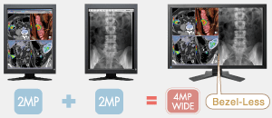 advantages
				                        of a 4mp bezel-less monitor